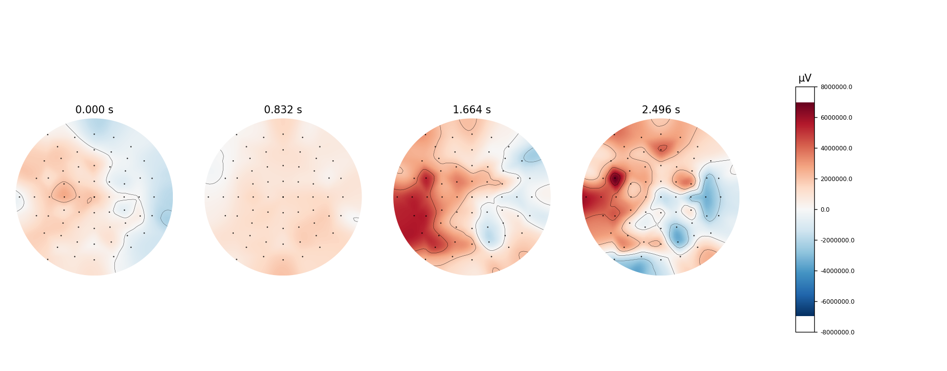 _images/EEG_ERP_topography.png