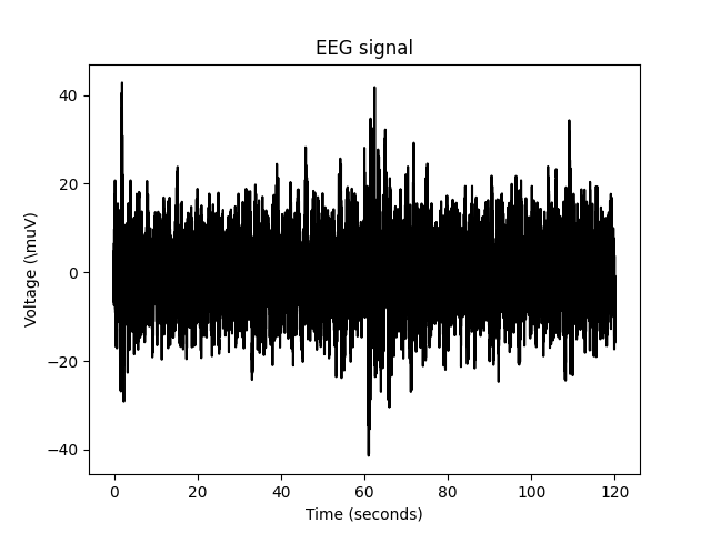 _images/EEG_signal.png