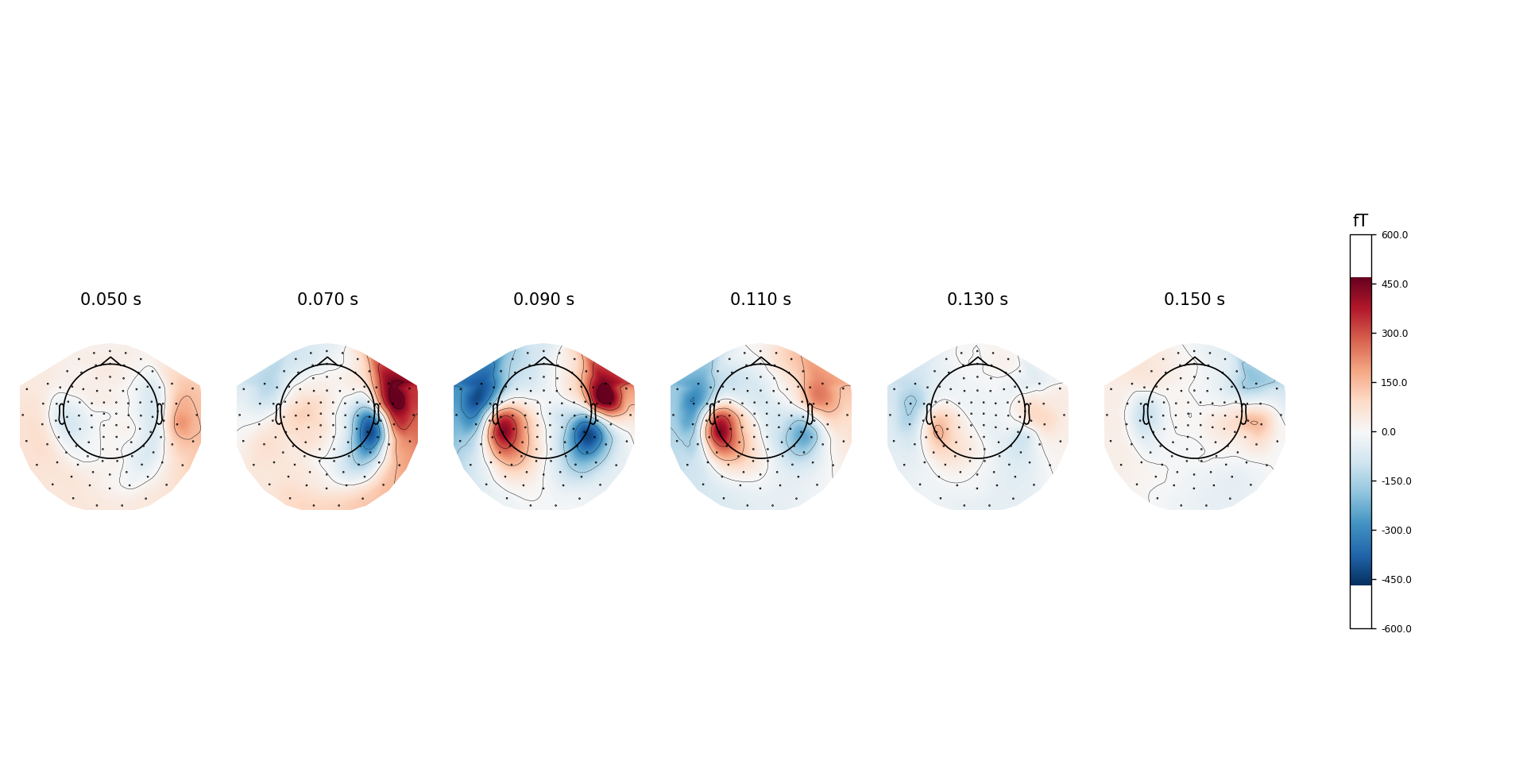 _images/topography_mne_example.png